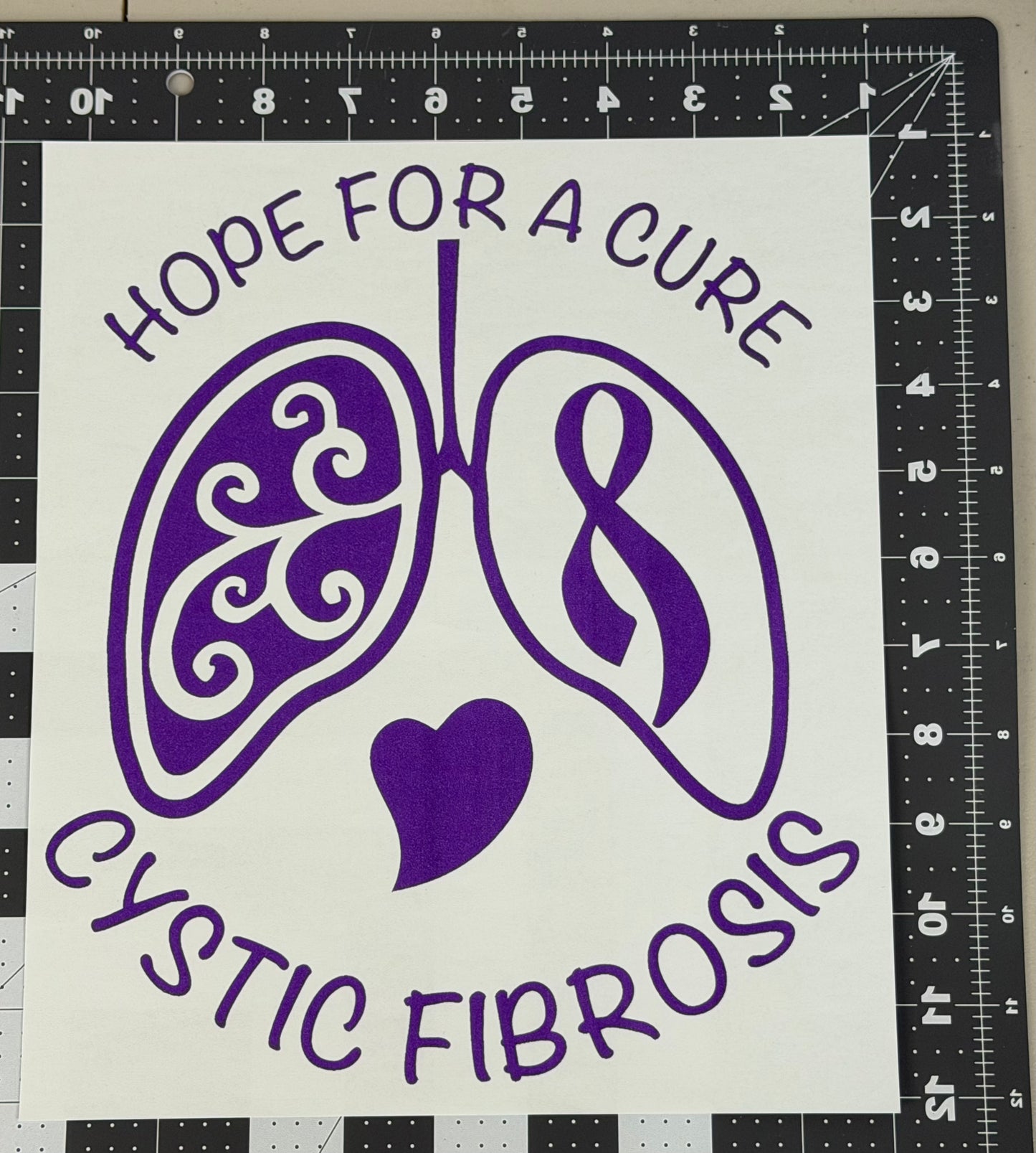 Hope For A Cure: Cystic Fibrosis